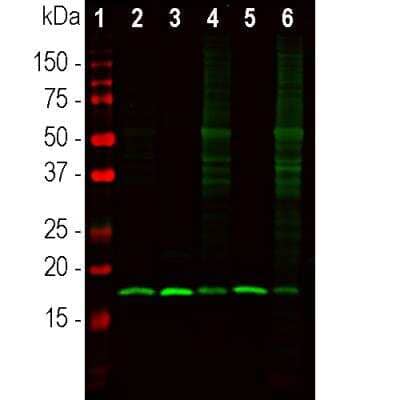 Western Blot: beta-Synuclein Antibody [NBP3-05556]