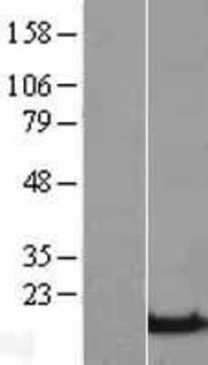 Western Blot: beta-Synuclein Overexpression Lysate [NBL1-16275]