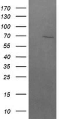 Western Blot: beta-TrCP1/BTRC Antibody (OTI2H2) [NBP2-46588]