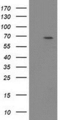 Western Blot: beta-TrCP1/BTRC Antibody (OTI3D5) [NBP2-03654]