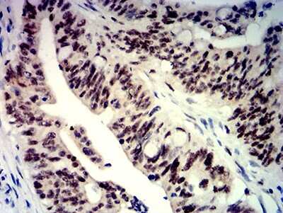 Immunohistochemistry: beta-TrCP1/BTRC Antibody (3D5E6) - BSA Free [NBP2-61713]