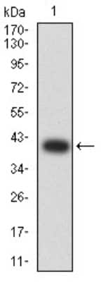 Western Blot: beta-TrCP1/BTRC Antibody (3D5E6)BSA Free [NBP2-61713]
