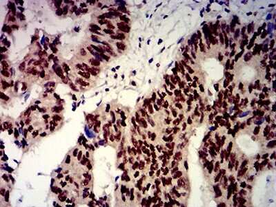 Immunohistochemistry: beta-TrCP1/BTRC Antibody (4C5D8) - BSA Free [NBP2-61712]