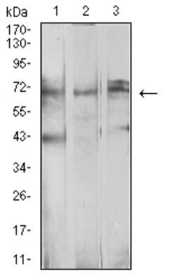 Western Blot: beta-TrCP1/BTRC Antibody (4C5D8)BSA Free [NBP2-61712]