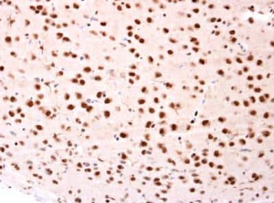 Immunohistochemistry-Paraffin: beta-TrCP1/BTRC Antibody [NBP1-33301]