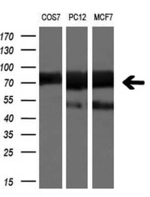 Western Blot: beta-TrCP1/BTRC Antibody (OTI2H2)Azide and BSA Free [NBP2-71402]