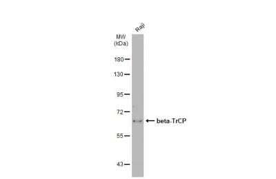 Western Blot: beta-TrCP1/BTRC Antibody [NBP1-33301]