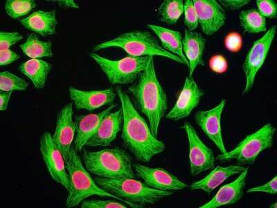 Immunocytochemistry/ Immunofluorescence: beta Tubulin Antibody (4E4) [NBP2-50047]