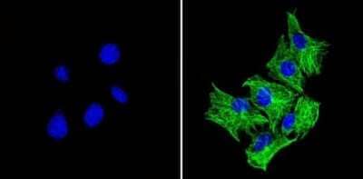 Immunocytochemistry/ Immunofluorescence: beta Tubulin Antibody (BT7R) - Azide and BSA Free [NBP2-37830]