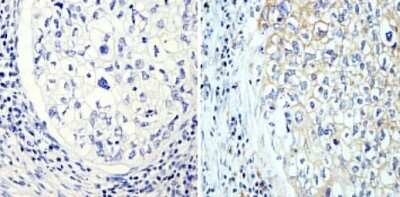 Immunohistochemistry-Paraffin: beta Tubulin Antibody (BT7R) - Azide and BSA Free [NBP2-37830]