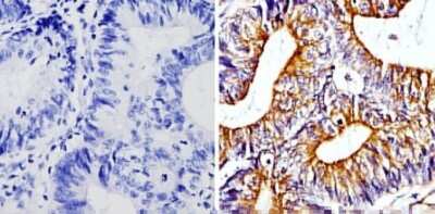 Immunohistochemistry-Paraffin: beta Tubulin Antibody (BT7R) - Azide and BSA Free [NBP2-37830]