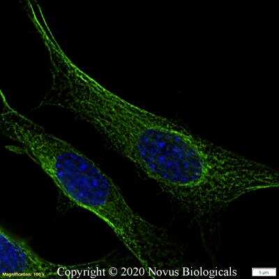 Immunocytochemistry/ Immunofluorescence: beta Tubulin Antibody - BSA Free [NB600-936]