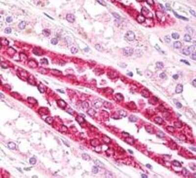 Immunohistochemistry-Paraffin: beta Tubulin Antibody [NB100-56459]
