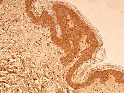 Immunohistochemistry-Paraffin: beta Tubulin Antibody - BSA Free [NB600-936]