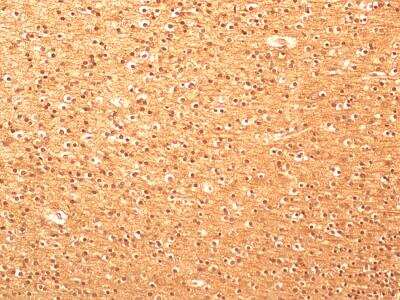 Immunohistochemistry-Paraffin: beta Tubulin Antibody - BSA Free [NB600-936]