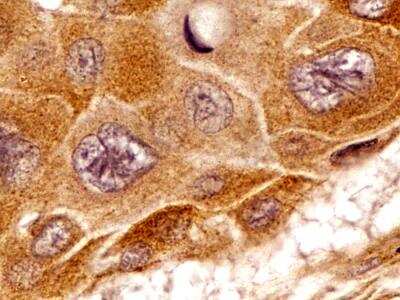 Immunohistochemistry-Paraffin: beta Tubulin Antibody - BSA Free [NB600-936]