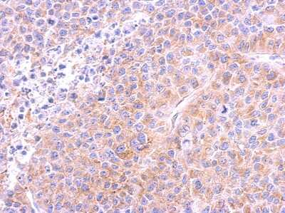 Immunohistochemistry-Paraffin: beta Tubulin Antibody [NBP2-15584]