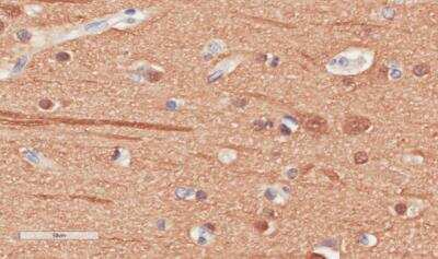 Immunohistochemistry-Paraffin: beta Tubulin Antibody (S11B) - Chimeric - Azide and BSA Free [NBP2-81064]