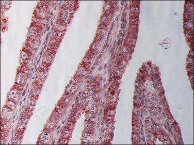 Immunohistochemistry-Paraffin: beta Tubulin Antibody (SAP.4G5) [NB120-11312]