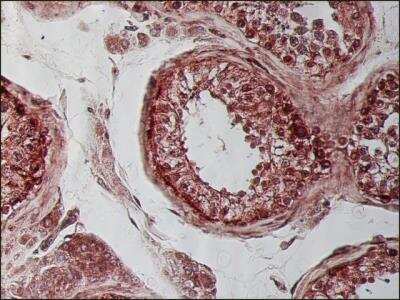 Immunohistochemistry-Paraffin: beta Tubulin Antibody (SAP.4G5) [NB120-11312]