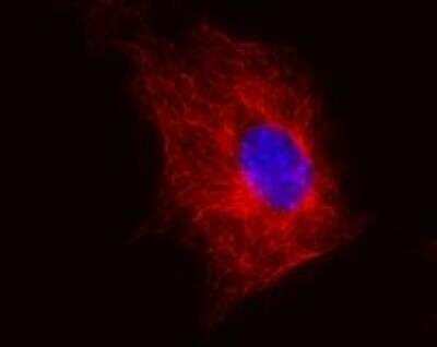 Immunocytochemistry/ Immunofluorescence: beta Tubulin Antibody (TU-06) [NB120-7792]