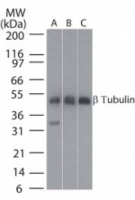 Western Blot: beta Tubulin Antibody [NB100-56459]