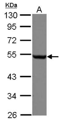 Western Blot: beta Tubulin Antibody [NBP2-15584]