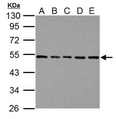 Western Blot: beta Tubulin Antibody [NBP2-15584]