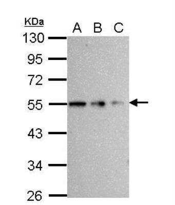 Western Blot: beta Tubulin Antibody [NBP2-15584]