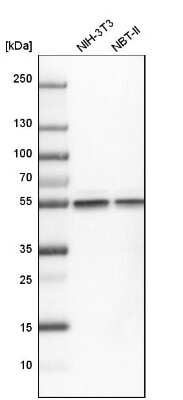 Western Blot: beta Tubulin Antibody [NBP2-54728]