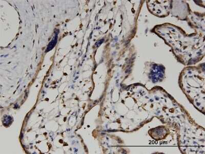 Immunohistochemistry-Paraffin: beta ureidopropionase Antibody (3F12) [H00051733-M09]