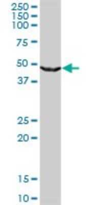 Western Blot: beta ureidopropionase Antibody (3F12) [H00051733-M09]