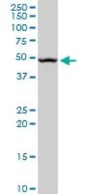 Western Blot: beta ureidopropionase Antibody (3F12) [H00051733-M09]