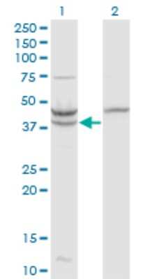 Western Blot: beta ureidopropionase Antibody (3F12) [H00051733-M09]