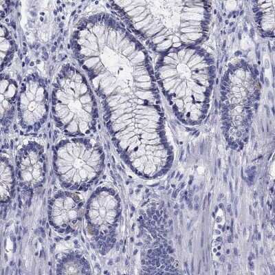 Immunohistochemistry-Paraffin: beta ureidopropionase Antibody [NBP3-17074]