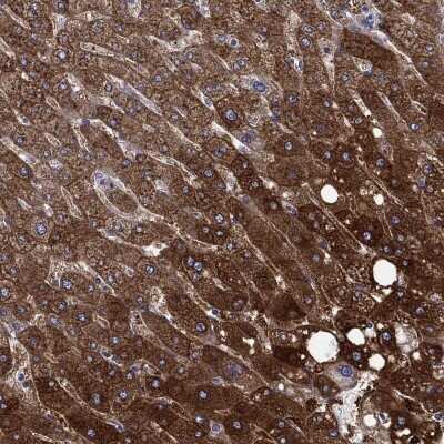 Immunohistochemistry-Paraffin: beta ureidopropionase Antibody [NBP3-17074]