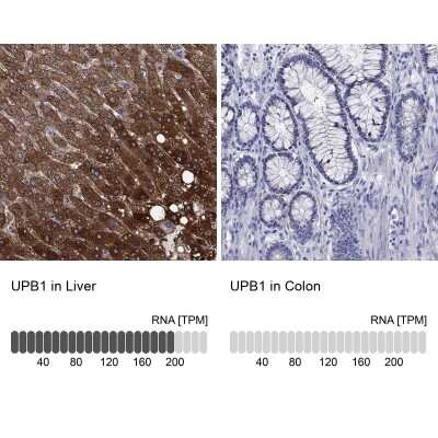 Immunohistochemistry-Paraffin: beta ureidopropionase Antibody [NBP3-17074]
