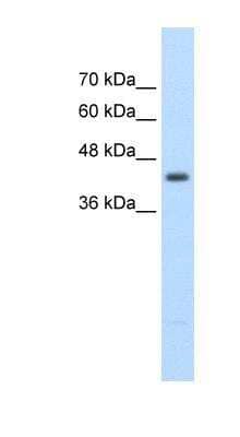 Western Blot: beta ureidopropionase Antibody [NBP1-54393]