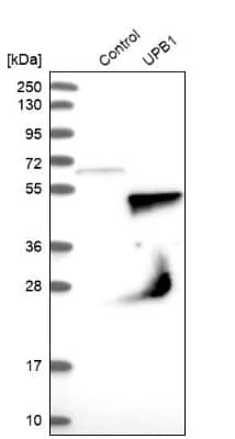 Western Blot: beta ureidopropionase Antibody [NBP1-89918]