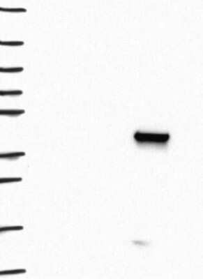 Western Blot: beta ureidopropionase Antibody [NBP3-17074]