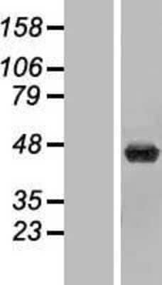 Western Blot: beta ureidopropionase Overexpression Lysate [NBP2-07056]