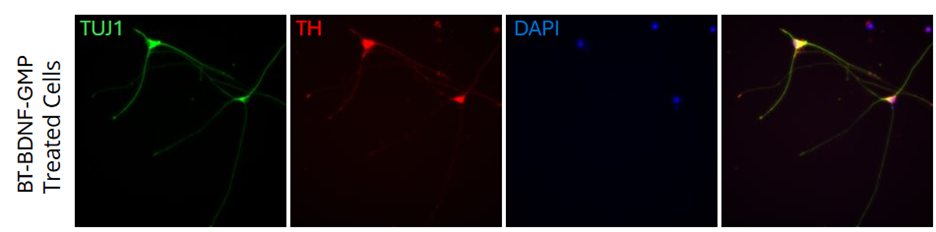 immunofluorescence images of dopaminergic neurons differentiated using BT-BDNF-GMP