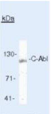 Western Blot: c-Abl Antibody (8E9) [NBP2-49695]