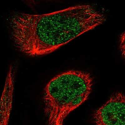 Immunocytochemistry/ Immunofluorescence: c-Abl Antibody [NBP1-90289]