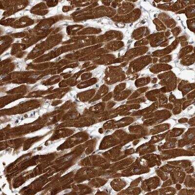 Immunohistochemistry-Paraffin: c-Abl Antibody [NBP1-90288]