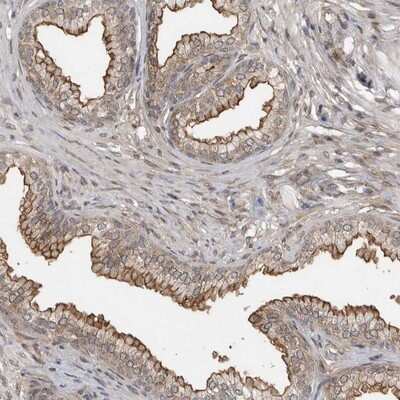 Immunohistochemistry-Paraffin: c-Abl Antibody [NBP1-90287]