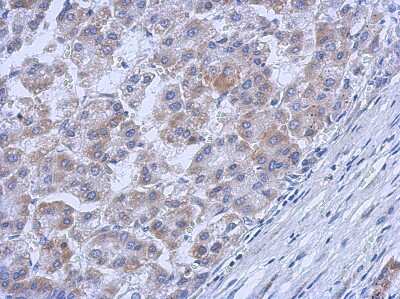 Immunohistochemistry-Paraffin: c-Abl Antibody [NBP2-15631]
