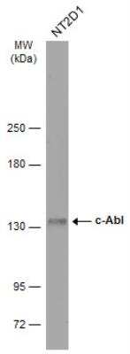 Western Blot: c-Abl Antibody [NBP2-15631]