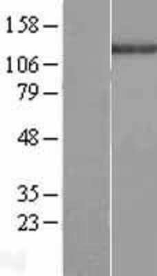 Western Blot: c-Abl Overexpression Lysate [NBL1-07208]