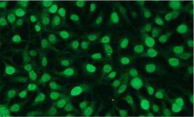 Immunohistochemistry-Paraffin: c-Fos Antibody (F14-R) [NBP3-08197]